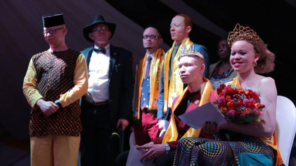 Des albinos renversent les préjugés au Kenya lors d’un concours de beauté