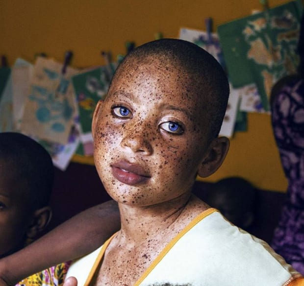 Qui est Grace Esther, la petite camerounaise aux yeux bleus qui fait le buzz?